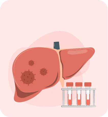 Lab Test | Liver Profiles